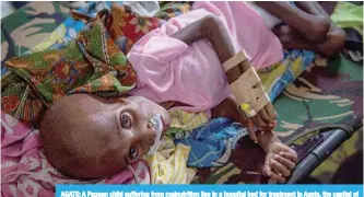  ??  ?? AGATS: A Papuan child suffering from malnutriti­on lies in a hospital bed for treatment in Agats, the capital of Asmat district in Indonesia’s easternmos­t Papua province. —AFP