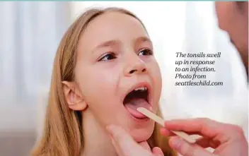  ??  ?? The tonsils swell up in response to an infection. Photo from seattlesch­ild.com