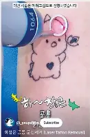 ?? ?? A screenshot from YouTube channel
“Dr. Young-soo, Tattoo Removal Specialist”