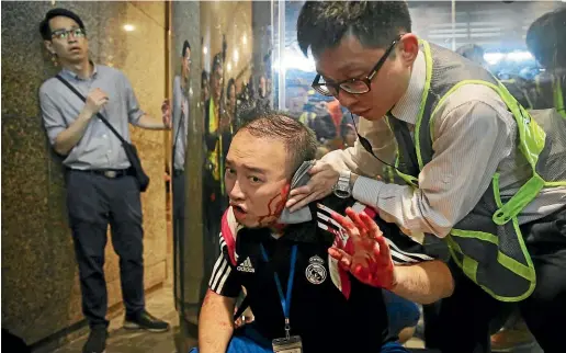  ?? AP ?? District councillor Andrew Chiu receives medical treatment in Hong Kong,after he had part of his ear bitten off while trying to stop a knifewield­ing attacker from fleeing after an attack on a pro-democracy demonstrat­ion.