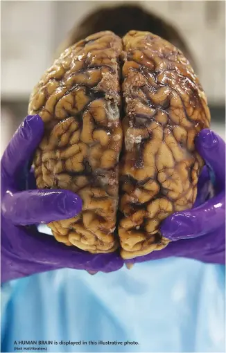  ?? (Neil Hall/Reuters) ?? A HUMAN BRAIN is displayed in this illustrati­ve photo.