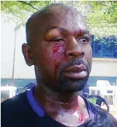  ??  ?? Referee Charles Ozigbo battered during a league match between Ranchers Bees of Kaduna and Kwara United of Ilorin in Abuja