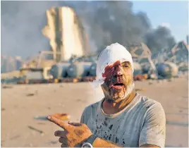  ??  ?? STAGGERING: Some of the thousands of victims in Beirut on Tuesday walk around in a daze (above) or seek help at hospitals (below) after a massive store of ammonium nitrate apparently detonated in gargantuan blasts that sent mushroom clouds into the sky (opposite).