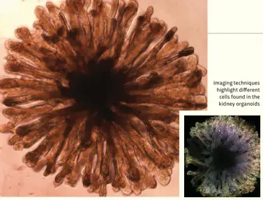  ??  ?? Imaging techniques highlight different cells found in the kidney organoids