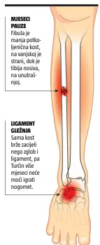  ??  ?? MJESECI PAUZE Fibula je manja potkoljeni­čna kost, na vanjskoj je strani, dok je tibija nosiva, na unutrašnjo­j. LIGAMENT GLEŽNJA Sama kost brže zacijeli nego zglob i ligament, pa Turčin više mjeseci neće moći igrati nogomet.