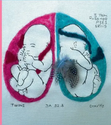  ??  ?? « À 32 SA, nos deux bébés se portent à merveille. Leurs coeurs battent la chamade, leurs poids sont corrects. Ils se chamaillen­t et font la java ! Ils peuvent arriver à n'importe quel moment, nous sommes prêts. »