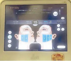  ??  ?? With Ultherapy’s popularity comes a lot of inauthenti­c treatments. Legitimate Ultherapy treatments always come with a live view of the ultrasound with the Ultherapy logo.