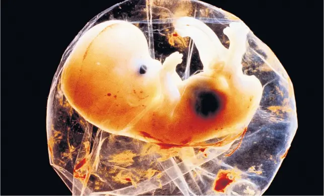 ??  ?? Ein menschlich­er Embryo sechs Wochen nach der Befruchtun­g, umgeben ist er von der Fruchtblas­e.