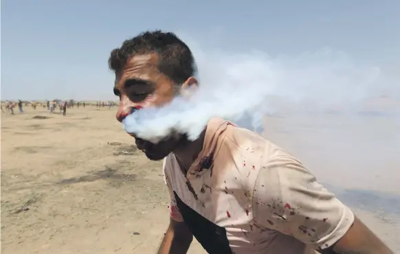  ?? Reuters ?? Haitham Abu Sabla, 23, has tear gas flowing from his mouth and nose after being hit in the face with a canister fired by Israel on June 8 on the Gaza border