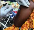  ?? PICTURE: WASHINGTON POST ?? A woman receives an experiment­al Ebola vaccine at a makeshift clinic on the outskirts of the Congolese city of Mbandaka in early June.