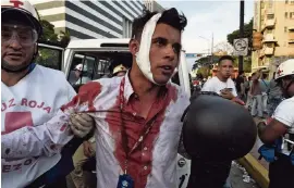  ?? FEDERICO PARRA AFP/Getty Images ?? Venezuelan VPI TV journalist Gregory Jaimes is assisted by paramedics after being injured during clashes between anti-Maduro protesters and security forces on Wednesday.