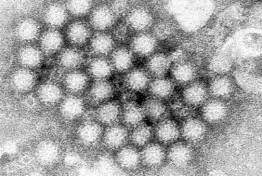  ?? ?? Cases of norovirus, a nasty stomach bug that spreads easily, are climbing, says CDC.