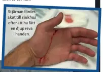  ??  ?? Stjärnan fördes akut till sjukhus efter att ha fått en djup reva i handen.