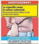  ?? HEALTH CANADA THE CANADIAN PRESS ?? A cigarette package shows a man with a colostomy bag warning ‘you may need to use a bag as a toilet for the rest of your life.’