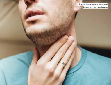  ?? ?? Fungus in a man’s throat caused his voice to become hoarse