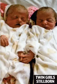  ??  ?? Twins Ella and Lola were starved of oxygen to the brain TWIN GIRLS STILLBORN