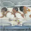  ?? FATIMA SHBAIR /THE ASSOCIATED PRES ?? BELOW: Babies in an incubator Friday at Emirati Hospital in Rafah, where a doctor says 16 preeemies have died of malnutriti­on-related causes.