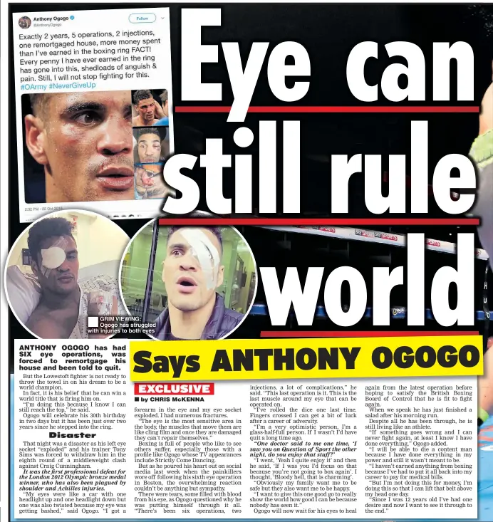  ??  ?? GRIM VIEWING: Ogogo has struggled with injuries to both eyes