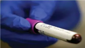  ?? THE ASSOCIATED PRESS ?? A lab assistant holds a blood sample to be tested for COVID-19 antibodies.