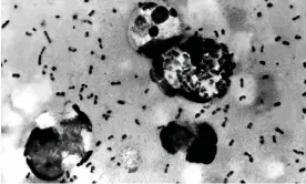  ?? Photograph: AFP/Getty Images ?? Bubonic plague bacteria taken from a patient in 2003.