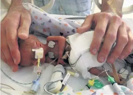  ??  ?? Chase Thomas weighed just 1.1lb when he was born at 30 weeks