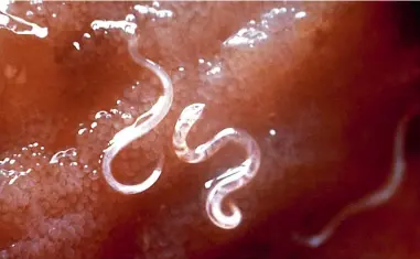  ??  ?? JOURNEY’S END: This enlargemen­t shows hookworms attached to the intestinal mucosa. Larvae penetrate the skin (often through bare feet), are carried to the lungs, go to the mouth, are swallowed and reach the small intestine.