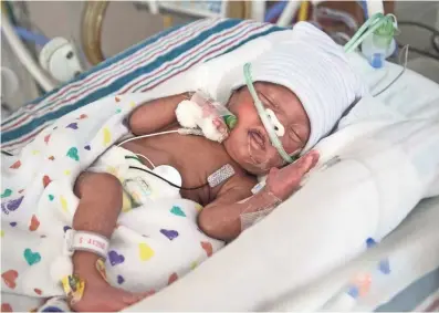  ?? BONHEUR CHILDREN'S HOSPITAL LE ?? Le Bonheur Children’s Hospital succeeded in implanting a newly approved device used to correct a heart defect inside a patient. Two-week-old Katelynn Davis was the first to receive the device on the morning of Feb. 6.