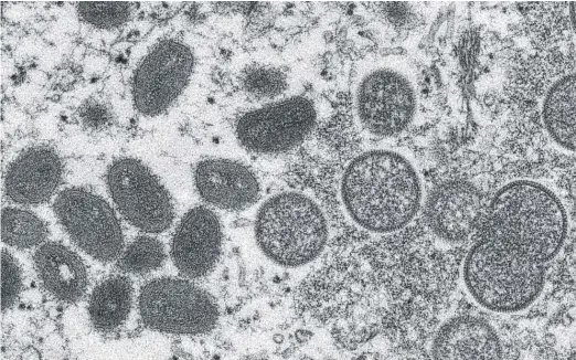  ?? CYNTHIA S. GOLDSMITH, RUSSELL REGNER/CDC VIA AP ?? This electron microscope image shows mature, oval-shaped monkeypox virions (left) and spherical immature virions (right) obtained from a sample of human skin associated with a 2003 prairie dog outbreak.