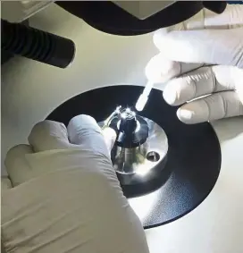  ??  ?? Each intraocula­r lens (IOl) passes through a full visual inspection and cleaning before being packaged.