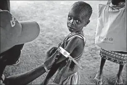  ?? [UNICEP FILE PHOTO] ?? A boy in Kuach, South Sudan, has his arm measured to see if he is suffering from malnutriti­on.