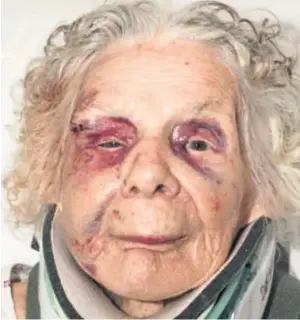  ??  ?? VICTIM: Zofija Kaczan, who survived a Nazi prison camp, suffered multiple injuries