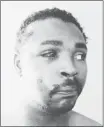  ?? Herald Archive, Associated Press ?? This photo of Rodney King was taken three days after his videotaped beating by police in Los Angeles on March 3, 1991.