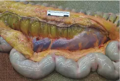  ??  ?? Left: an extremely oedematous (swollen) colon at post-mortem due to acorn poisoning