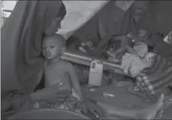  ?? TYLER HICKS, NYT ?? Mothers tend to their children at a cholera treatment centre in Baidoa, Somalia in March. Canadian Foodgrains’ John Longhurst says North American media have other matters competing for attention that perhaps are easier to cover.