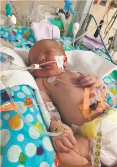  ?? COURTESY PHOTO ?? Liam Griffith was born May 17, 2015, with four different congenital heart defects. After surgeries attempting to repair the defects, Liam died less than a day after he was born.