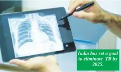  ?? ?? India has set a goal to eliminate TB by 2025.