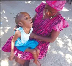  ?? Photo: Festus Hamalwa ?? In need… Secilia Petrus holding her eight-yearold son who requires a wheelchair.