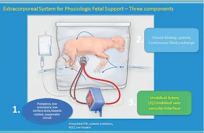  ??  ?? A major technical hurdle still to be crossed is downsizing the system, above, to make it suitable for human infants, which are a third of the size of the lambs used in the study.