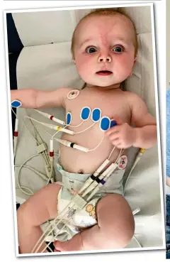  ??  ?? Intensive care: Six-month-old Oliver Cameron, who has a large tumour in his heart, being treated in hospital.