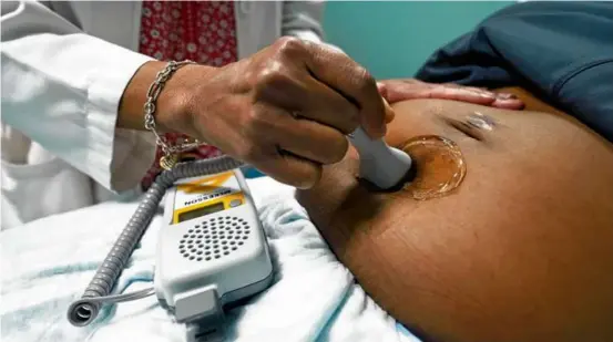  ?? ROGELIO V. SOLIS/AP ?? A doctor used a hand-held Doppler probe on a pregnant woman to measure the heartbeat of the fetus in 2021, in Jackson, Miss.