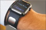  ?? Paul Chinn / The Chronicle ?? AliveCor just received FDA approval for its Kardia Band EKG-monitoring wristband for the Apple Watch.