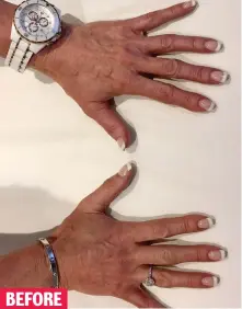  ??  ?? Sign of ageing: Veins stand out on presenter’s hands BEFORE