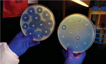  ?? Photograph: Science History Images/Alamy ?? A researcher holds up two culture plates showing bacteria that are susceptibl­e to antibiotic­s (left) and others that are not (right).