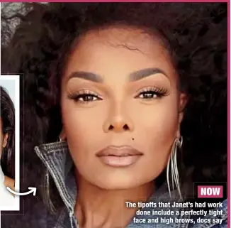  ?? ?? NOW
The tipoffs that Janet’s had work done include a perfectly tight face and high brows, docs say