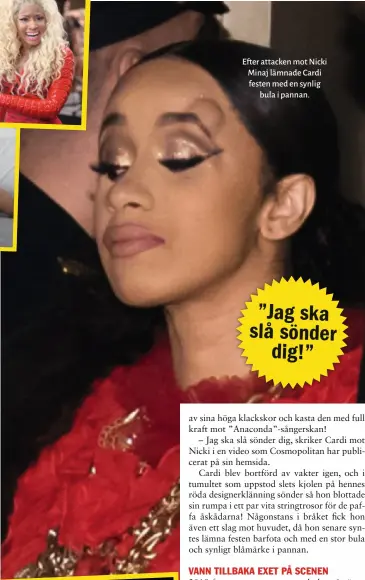  ??  ?? Efter attacken mot Nicki Minaj lämnade Cardi festen med en synlig bula i pannan.