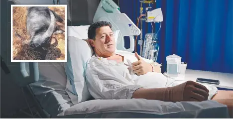  ?? Picture: MICHAEL FRANCHI ?? Danny Vanbrugh in hospital after he was gored by a buffalo, and (inset) the beast that attacked him