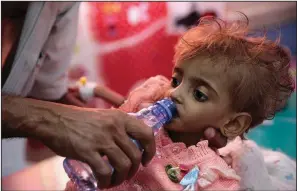  ?? AP/HANI MOHAMMED ?? A father gives water to his malnourish­ed daughter on Sept. 27 at a hospital feeding center in the embattled port city of Hodeida, the main port for Yemen’s food imports and internatio­nal aid.