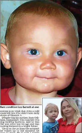 Boy Who Turned Orange Pressreader