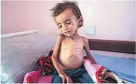  ??  ?? HUNGERSNØD: 14 millioner mennesker står ifølge FN på randen av sult i Jemen, der stadig mindre mat de siste ukene har blitt losset i den strategisk viktige havnebyen Hodeida. Bildet er tatt på et sykehus i Hajjah i oktober.