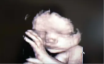  ?? FOTOPRESS — GETTY IMAGES ?? 3D ultrasound showing a baby inside the womb. Comments related to fetal screening for disabiliti­es got the chair of Framingham’s local Democratic Party committee in hot water.